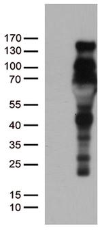 PGR Antibody in Western Blot (WB)