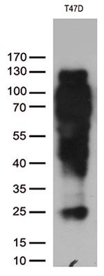 PGR Antibody in Western Blot (WB)