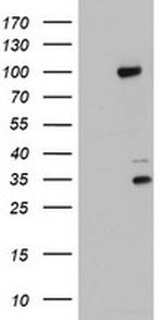 PGR Antibody in Western Blot (WB)