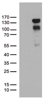 PGR Antibody in Western Blot (WB)
