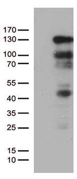 PGR Antibody in Western Blot (WB)