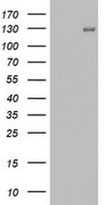 PGR Antibody in Western Blot (WB)
