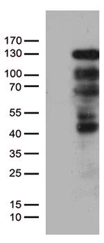 PGR Antibody in Western Blot (WB)