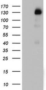 PGR Antibody in Western Blot (WB)