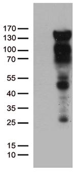 PGR Antibody in Western Blot (WB)