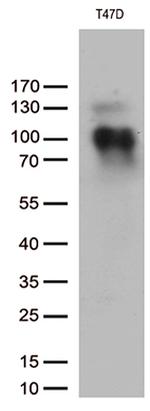 PGR Antibody in Western Blot (WB)