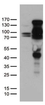 PGR Antibody in Western Blot (WB)