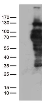 PGR Antibody in Western Blot (WB)