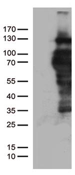 PGR Antibody in Western Blot (WB)