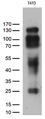 PGR Antibody in Western Blot (WB)