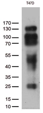 PGR Antibody in Western Blot (WB)
