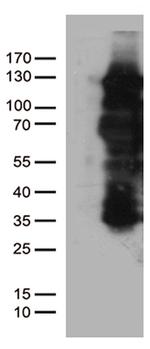 PGR Antibody in Western Blot (WB)