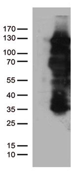 PGR Antibody in Western Blot (WB)