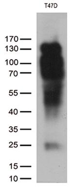 PGR Antibody in Western Blot (WB)