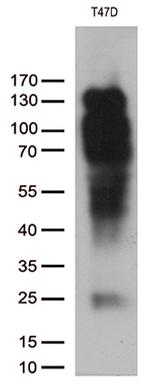 PGR Antibody in Western Blot (WB)