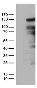 PGR Antibody in Western Blot (WB)