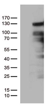 PGR Antibody in Western Blot (WB)