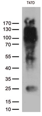PGR Antibody in Western Blot (WB)