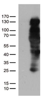 PGR Antibody in Western Blot (WB)