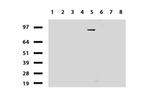 PGR Antibody in Western Blot (WB)