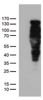PGR Antibody in Western Blot (WB)