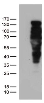 PGR Antibody in Western Blot (WB)