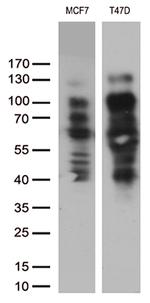 PGR Antibody in Western Blot (WB)