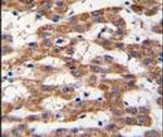 Prohibitin Antibody in Immunohistochemistry (IHC)