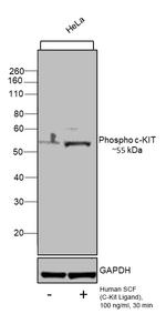 Human SCF Protein in Bioactivity (Bioactivity)