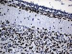 PHF20L1 Antibody in Immunohistochemistry (Paraffin) (IHC (P))