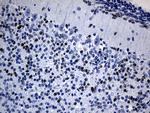 PHF20L1 Antibody in Immunohistochemistry (Paraffin) (IHC (P))