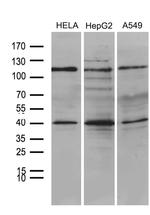 PHF20L1 Antibody in Western Blot (WB)