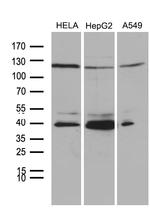 PHF20L1 Antibody in Western Blot (WB)