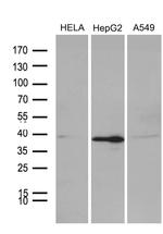 PHF20L1 Antibody in Western Blot (WB)