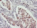 PHF21B Antibody in Immunohistochemistry (Paraffin) (IHC (P))