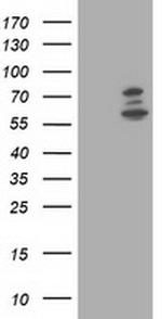 PHF21B Antibody in Western Blot (WB)