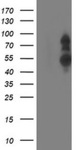 PHF21B Antibody in Western Blot (WB)