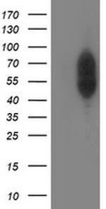 PHF21B Antibody in Western Blot (WB)