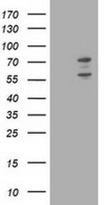 PHF21B Antibody in Western Blot (WB)