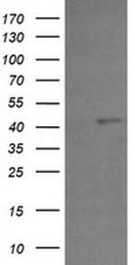PHF7 Antibody in Western Blot (WB)