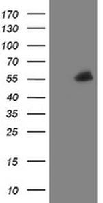 PHF7 Antibody in Western Blot (WB)
