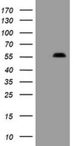 PHF7 Antibody in Western Blot (WB)
