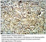Phospho-Histone H3 (Ser10) Antibody in Immunohistochemistry (IHC)