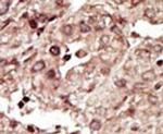 PHKG1 Antibody in Immunohistochemistry (IHC)