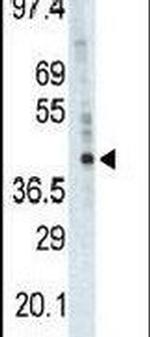PHKG1 Antibody in Western Blot (WB)