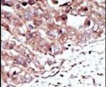 PHKG2 Antibody in Immunohistochemistry (IHC)