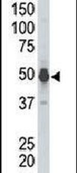 PHKG2 Antibody in Western Blot (WB)