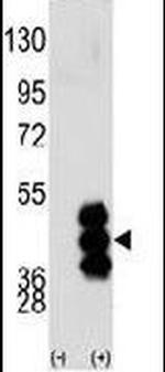 PHKG2 Antibody in Western Blot (WB)