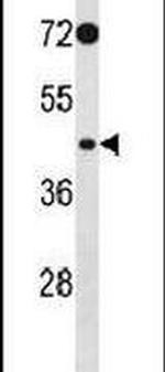 PHKG2 Antibody in Western Blot (WB)