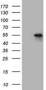 PHLDA1 Antibody in Western Blot (WB)